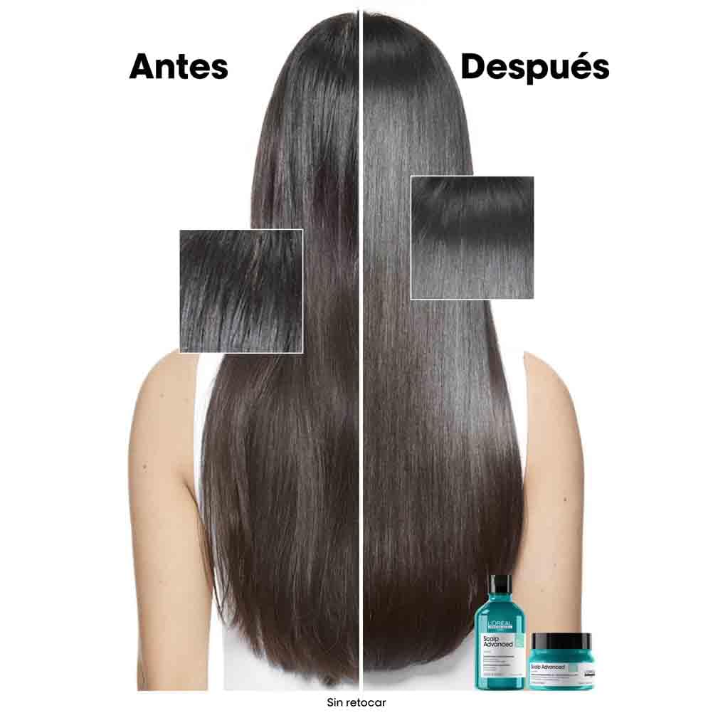 L’Oréal Professionnel, Shampoo Anti-Oleoso Enriquecido com Ingredientes Dermatologicamente Ativos para Couro Cabeludo Oleoso, Scalp Advanced, 300 ml