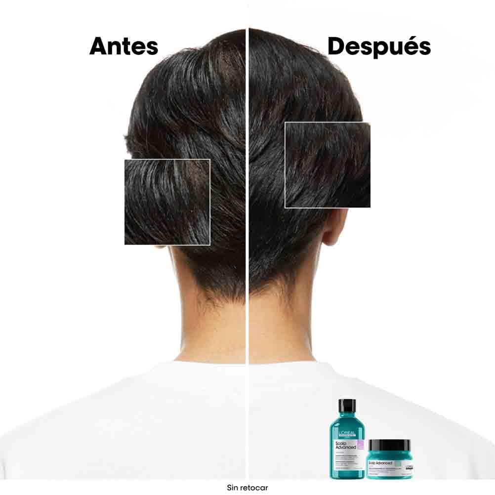 L’Oréal Professionnel, Shampoo Anti-Oleoso Enriquecido com Ingredientes Dermatologicamente Ativos para Couro Cabeludo Oleoso, Scalp Advanced, 300 ml