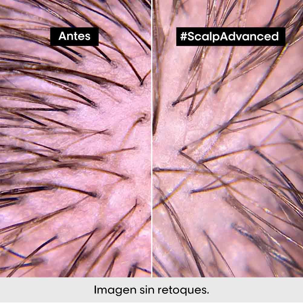 Shampoo L’Oréal Professionnel Enriquecido com Ingredientes Dermatologicamente Ativos para Cabelos Finos e Ralos, Serioxyl Advanced, 500 ml