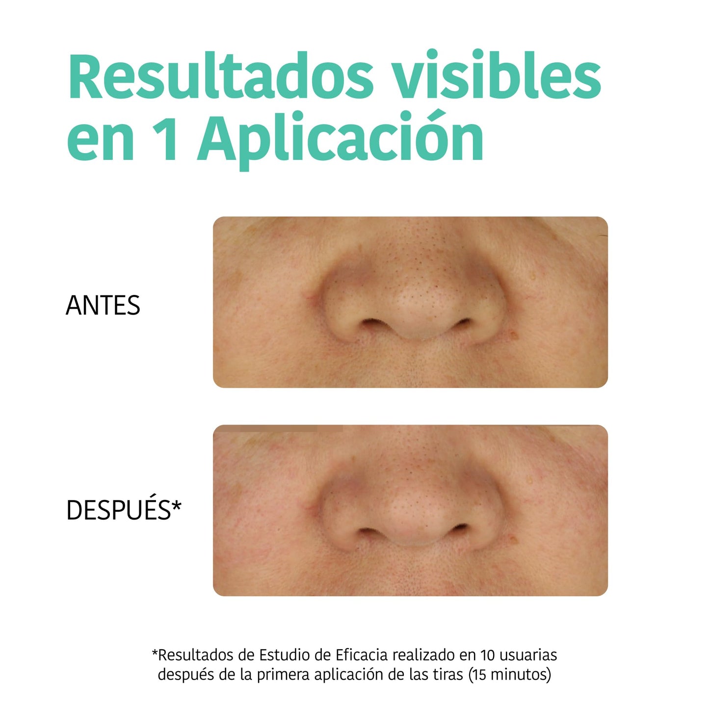 Adesivos para Espinhas com Ácido Salicílico - 18 unidades