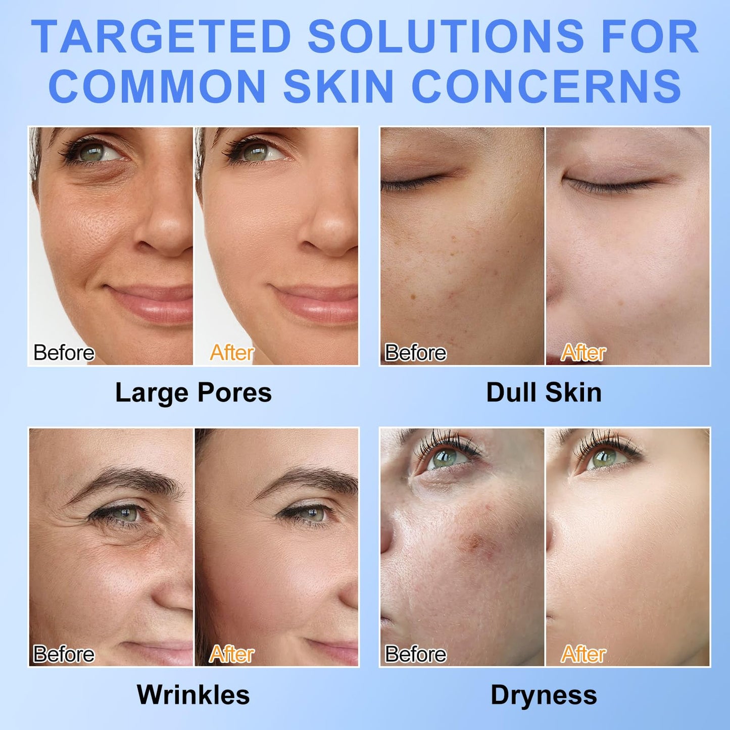 BIO COLLAGEN Máscara facial de 4 peças, máscara de hidratação profunda com biocolagenio