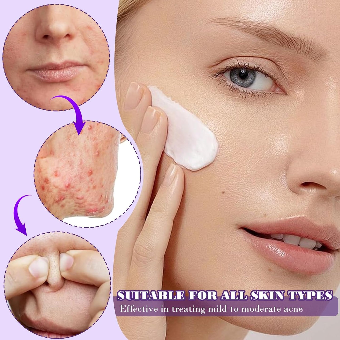 Creme reparador Reduz Acne e Vermelhidão, Hidratante Noturno para um Rosto Radiante, 20g