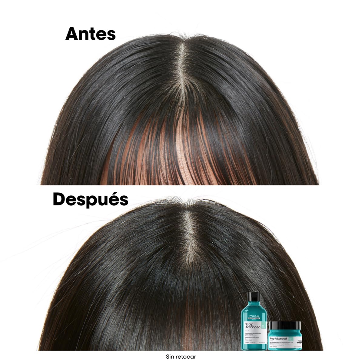 L’Oréal Professionnel, Shampoo Anti-Oleoso Enriquecido com Ingredientes Dermatologicamente Ativos para Couro Cabeludo Oleoso, Scalp Advanced, 300 ml