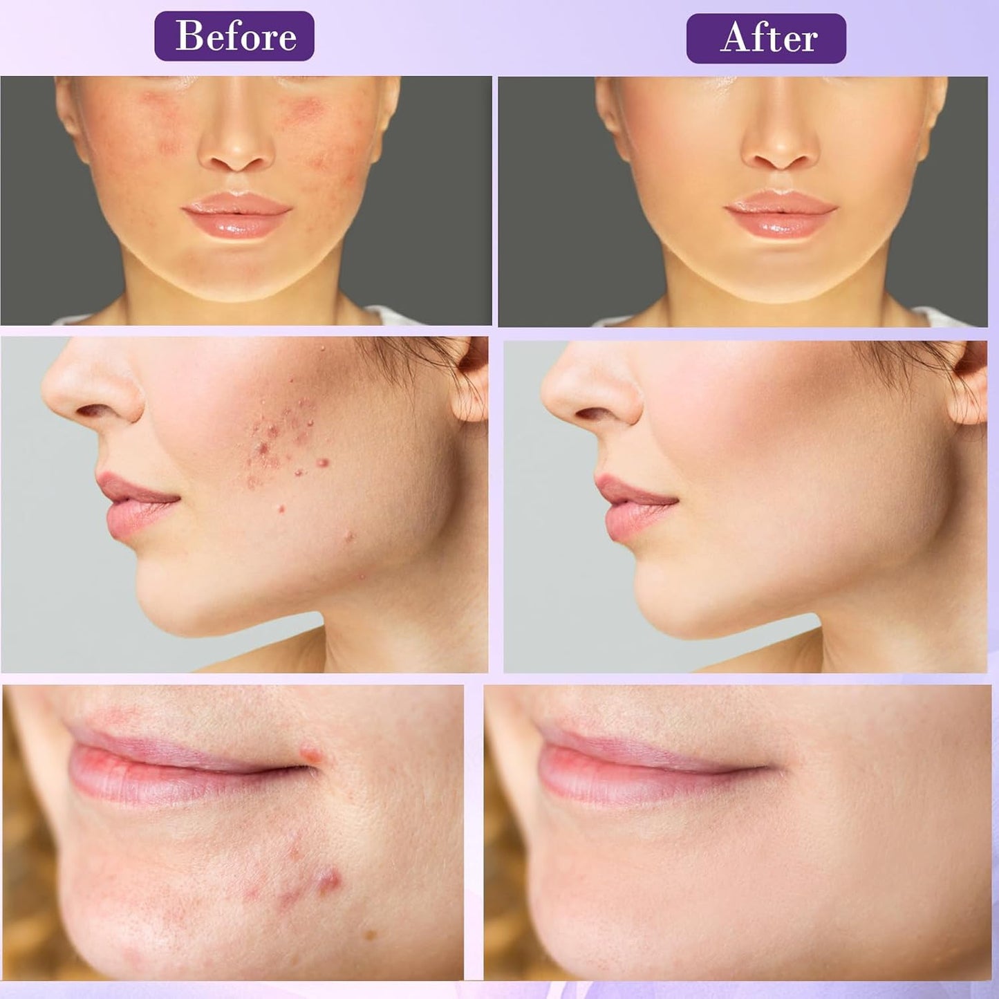 Creme reparador Reduz Acne e Vermelhidão, Hidratante Noturno para um Rosto Radiante, 20g