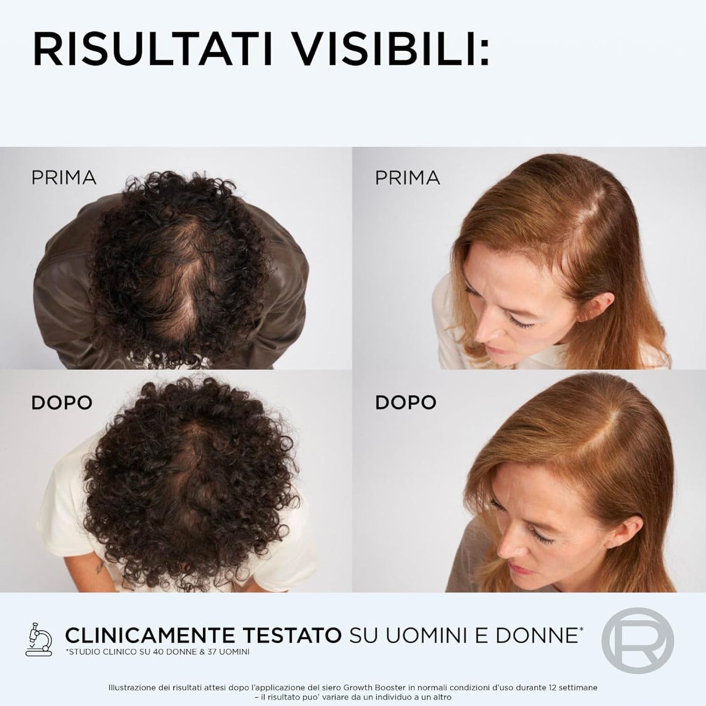 L'Oréal Paris Elvive Kit antiqueda Growth Booster para cabelos danificados - Conjunto com 3