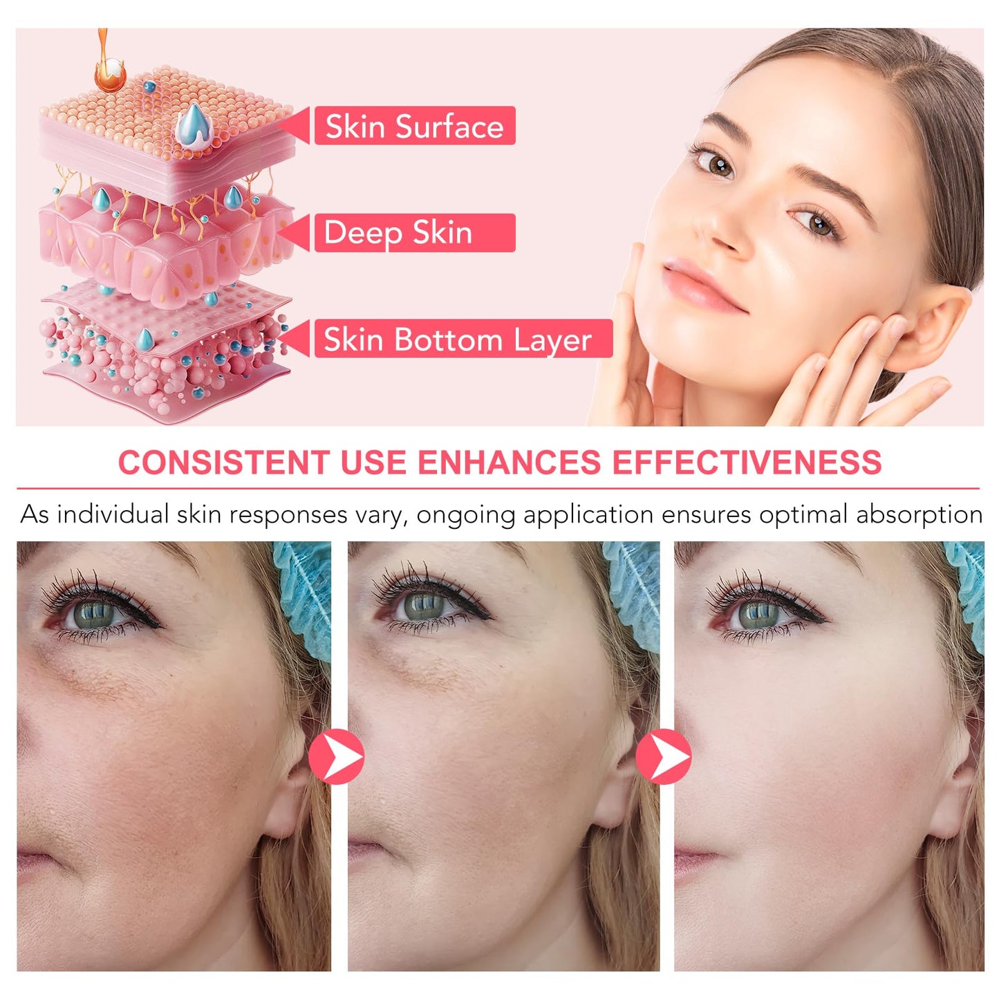 BIO COLLAGEN Máscara facial de 4 peças, máscara de hidratação profunda com biocolagenio