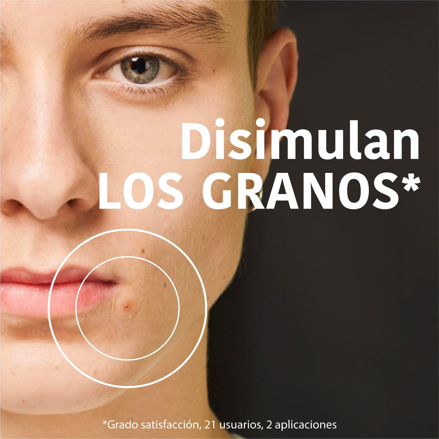 Adesivos para Espinhas com Ácido Salicílico - 18 unidades