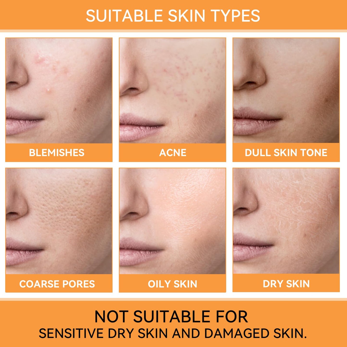 Ácido glicólico 7% Toning Resurfacing Solution, ácido glicólico, adequado para todos os tipos de pele