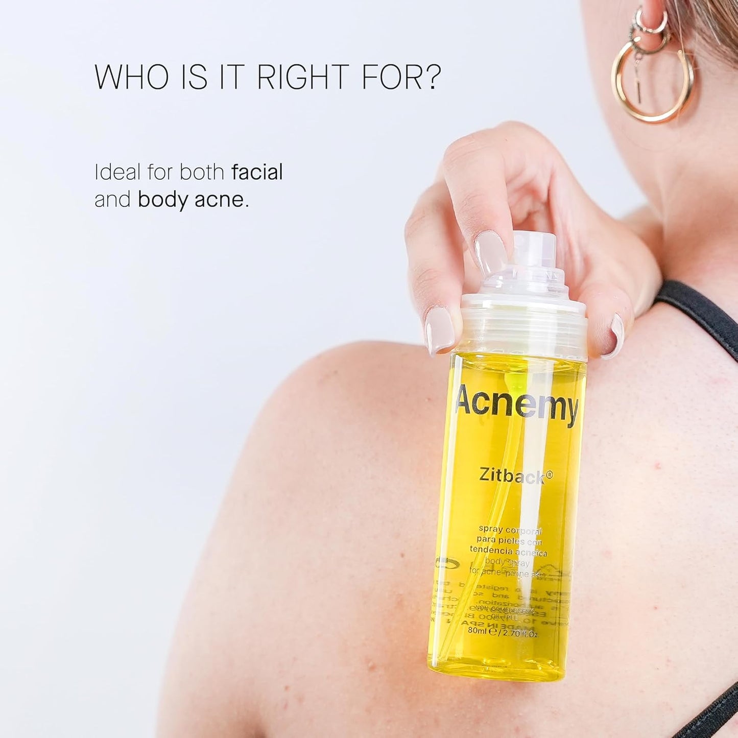 ACNEMY ZITBACK® - Spray corporal para pele com tendência a acne