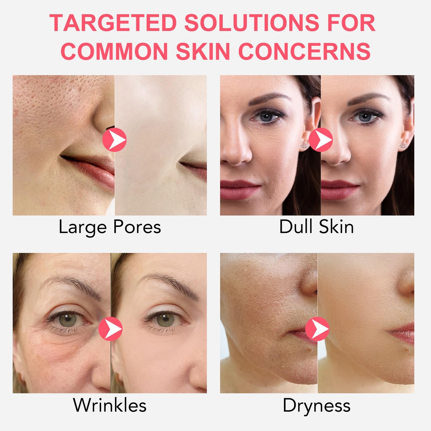 BIO COLLAGEN Máscara facial de 4 peças, máscara de hidratação profunda com biocolagenio