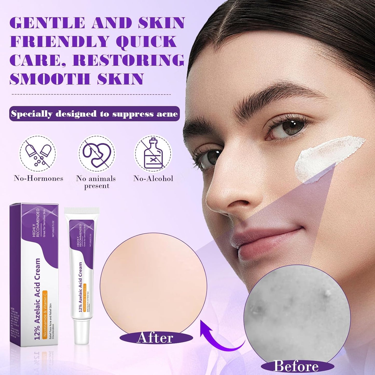 Creme reparador Reduz Acne e Vermelhidão, Hidratante Noturno para um Rosto Radiante, 20g