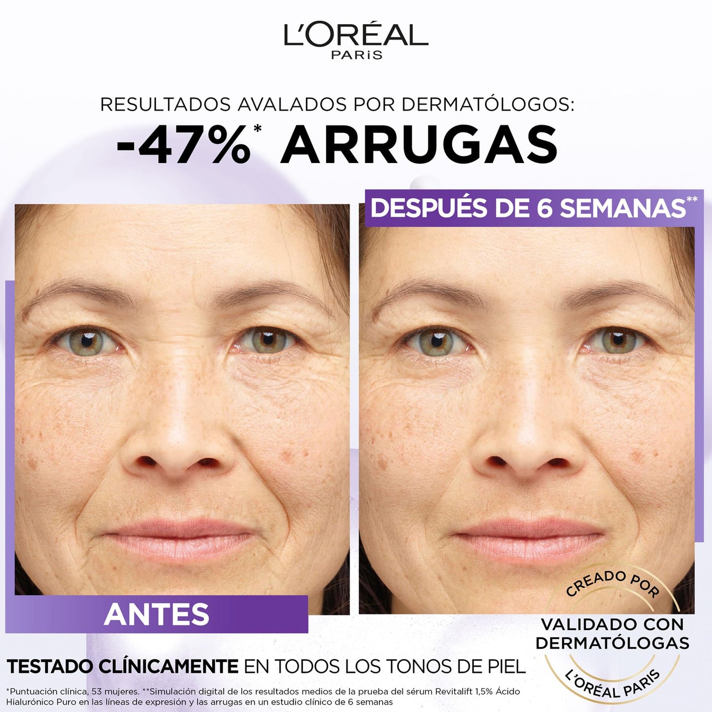 L'Oreal Paris Revitalift Filler Soro Antienvelhecimento 30ml