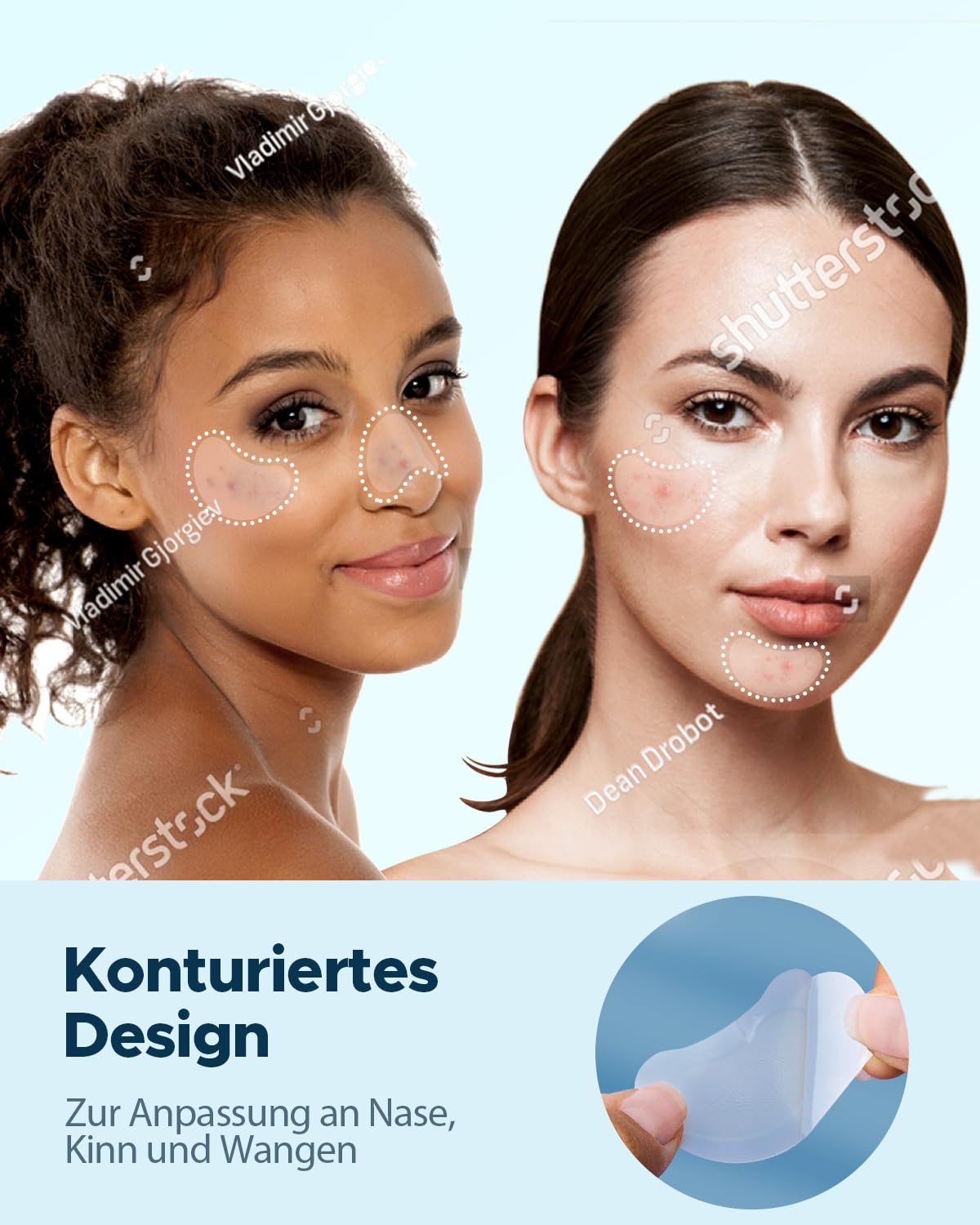 Adesivos para acne efeito rapido LitBear em 6 tamanhos com óleo de tea tree e calêndula para tratamento de espinhas.