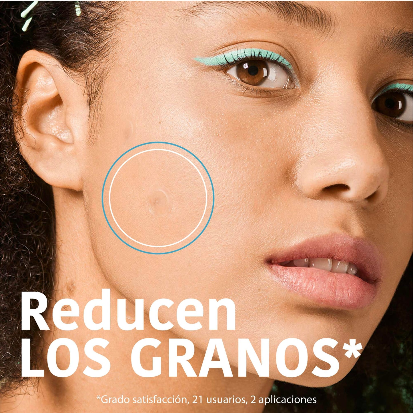 Adesivos para espinhas com ácido salicílico da Iroha Nature para redução eficaz de manchas de acne em 8 horas.