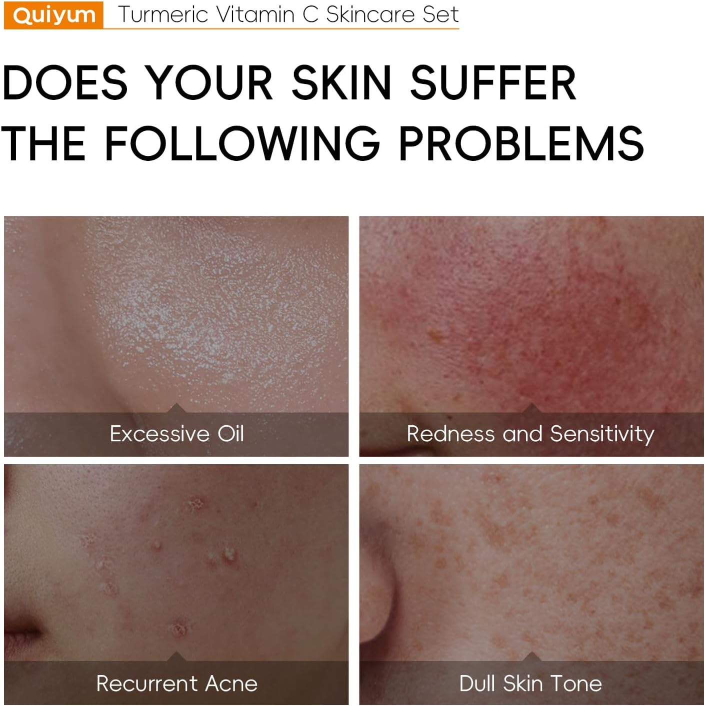 Conjunto de cuidados com a pele curcuma com 5 peças para cuidados faciais, incluindo leite de limpeza e cremes