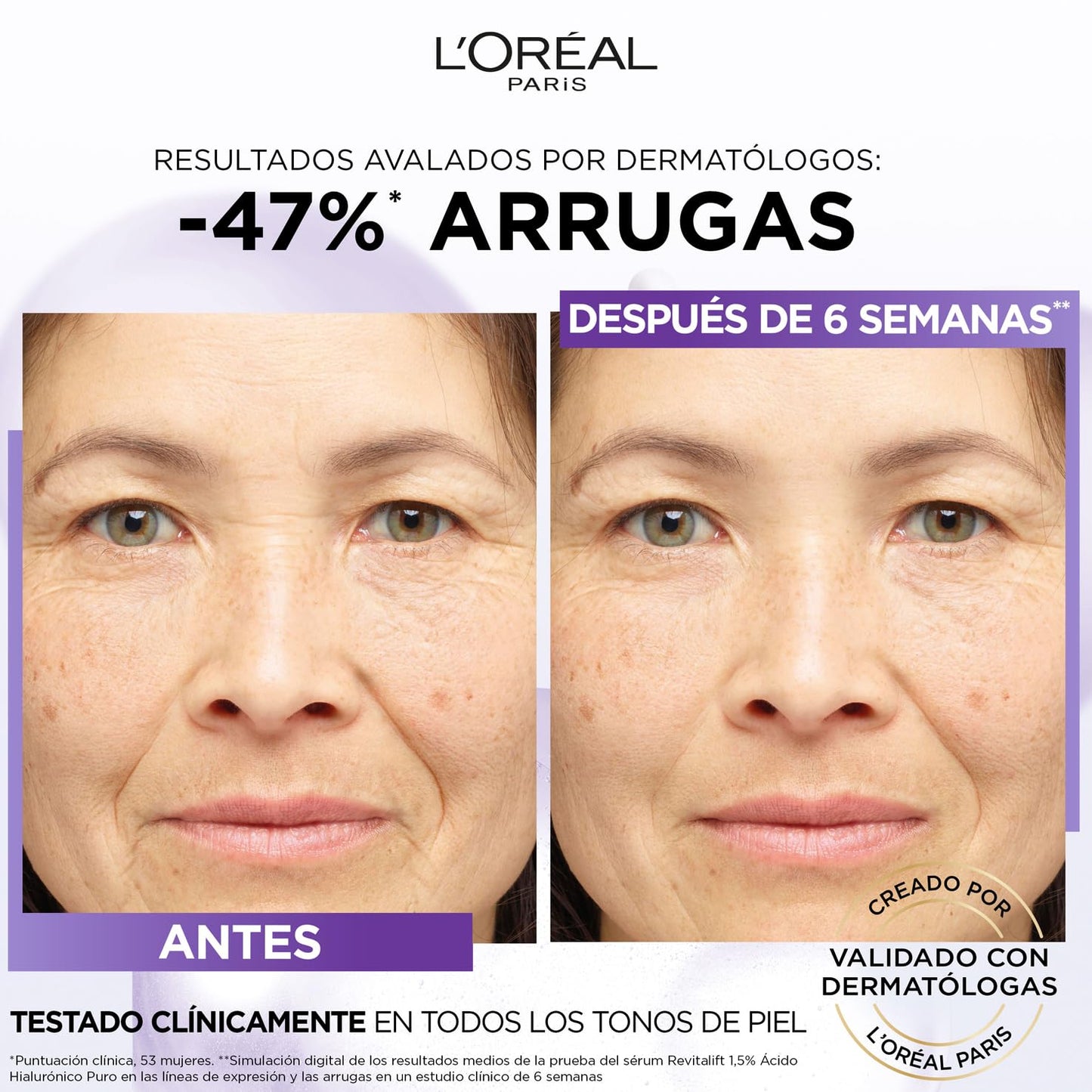 L'Oreal Paris Revitalift Filler Soro Antienvelhecimento com Ácido Hialurônico Puro, 30 ml, para redução de rugas