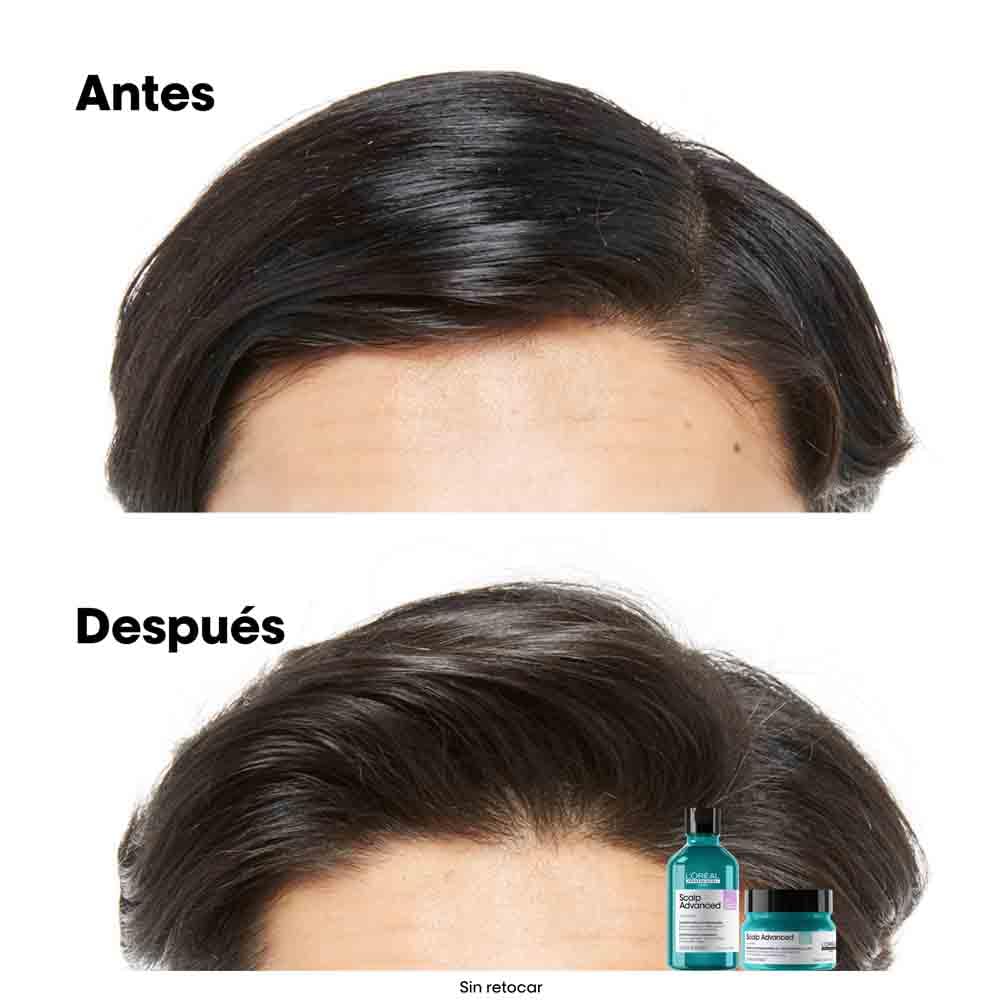 L’Oréal Professionnel, Shampoo Anti-Oleoso Enriquecido com Ingredientes Dermatologicamente Ativos para Couro Cabeludo Oleoso, Scalp Advanced, 300 ml
