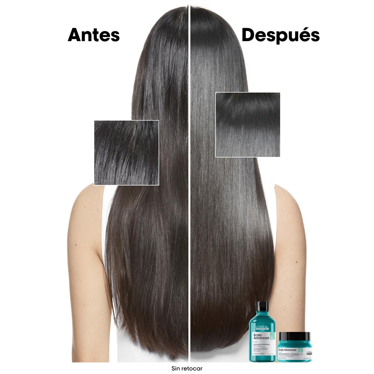 L’Oréal Professionnel, Shampoo Anti-Oleoso Enriquecido com Ingredientes Dermatologicamente Ativos para Couro Cabeludo Oleoso, Scalp Advanced, 300 ml