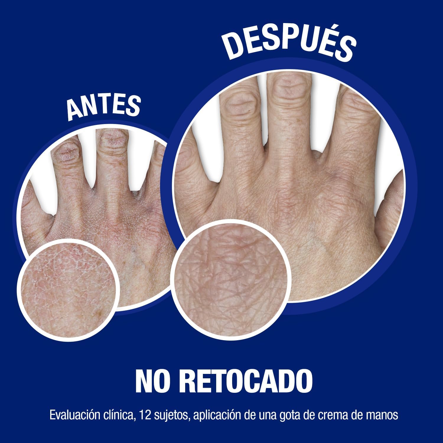 Creme para mãos Neutrogena em embalagem de 2 x 75 ml para mãos rachadas e secas com glicerina e vitamina E