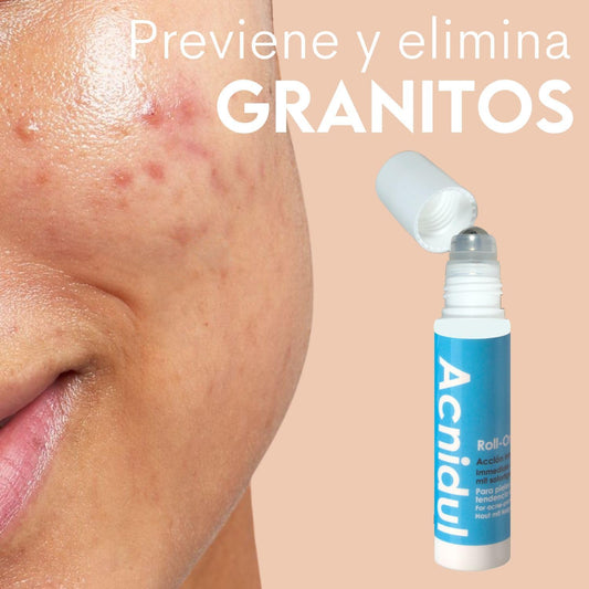 ACNIDUL | Roll-on de ação imediata com ácido glicólico e calêndula | Remova espinhas do seu rosto | 14 ml |