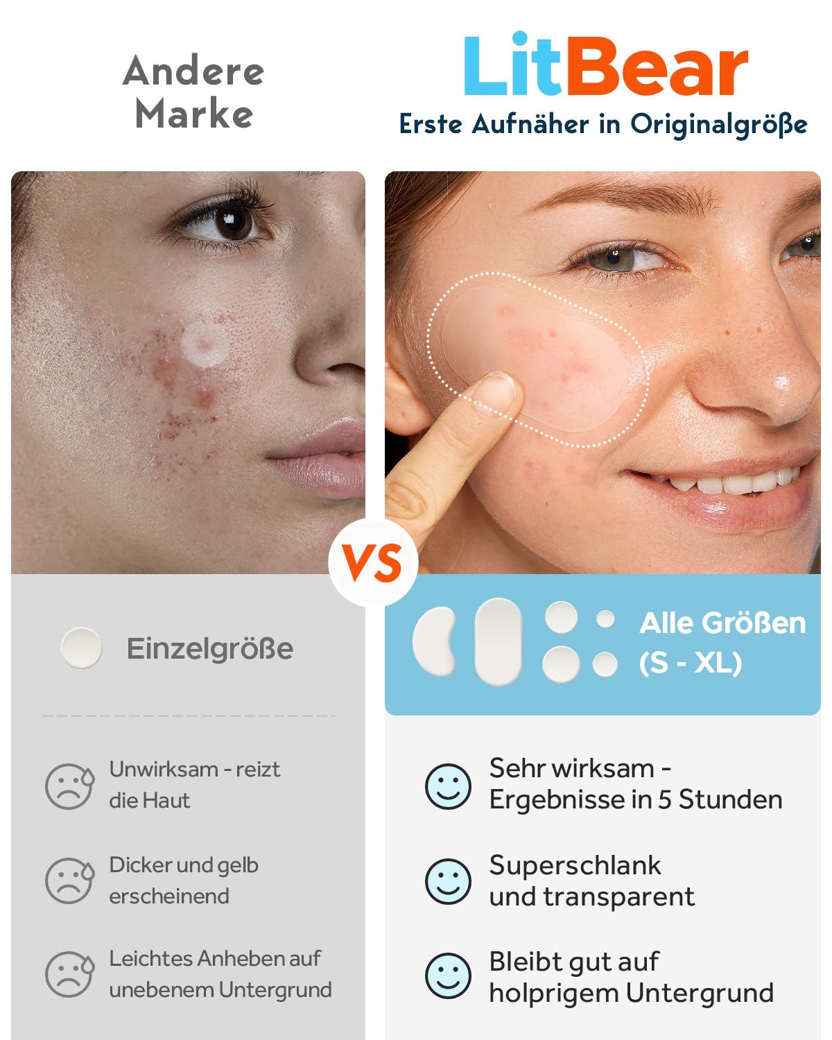 Adesivos para Acne Efeito Rapido - varios tamanhos