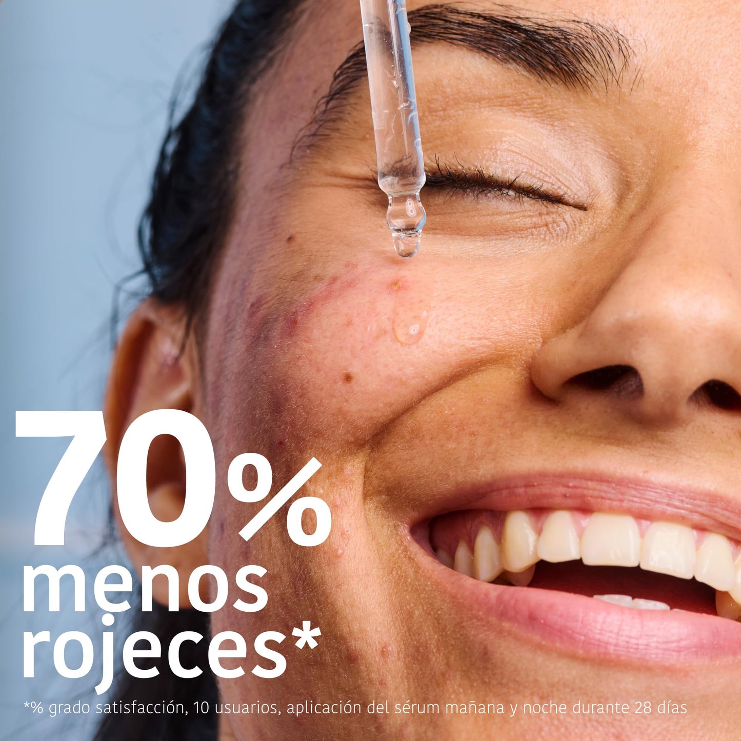 Iroha Nature - Sérum Anti-Imperfeições Ácido Salicílico 2% Niacinamida 3,5%