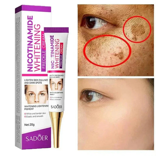 Creme clareador com nicotinamida da marca SADOER, para iluminar a pele, especialmente em áreas com manchas.